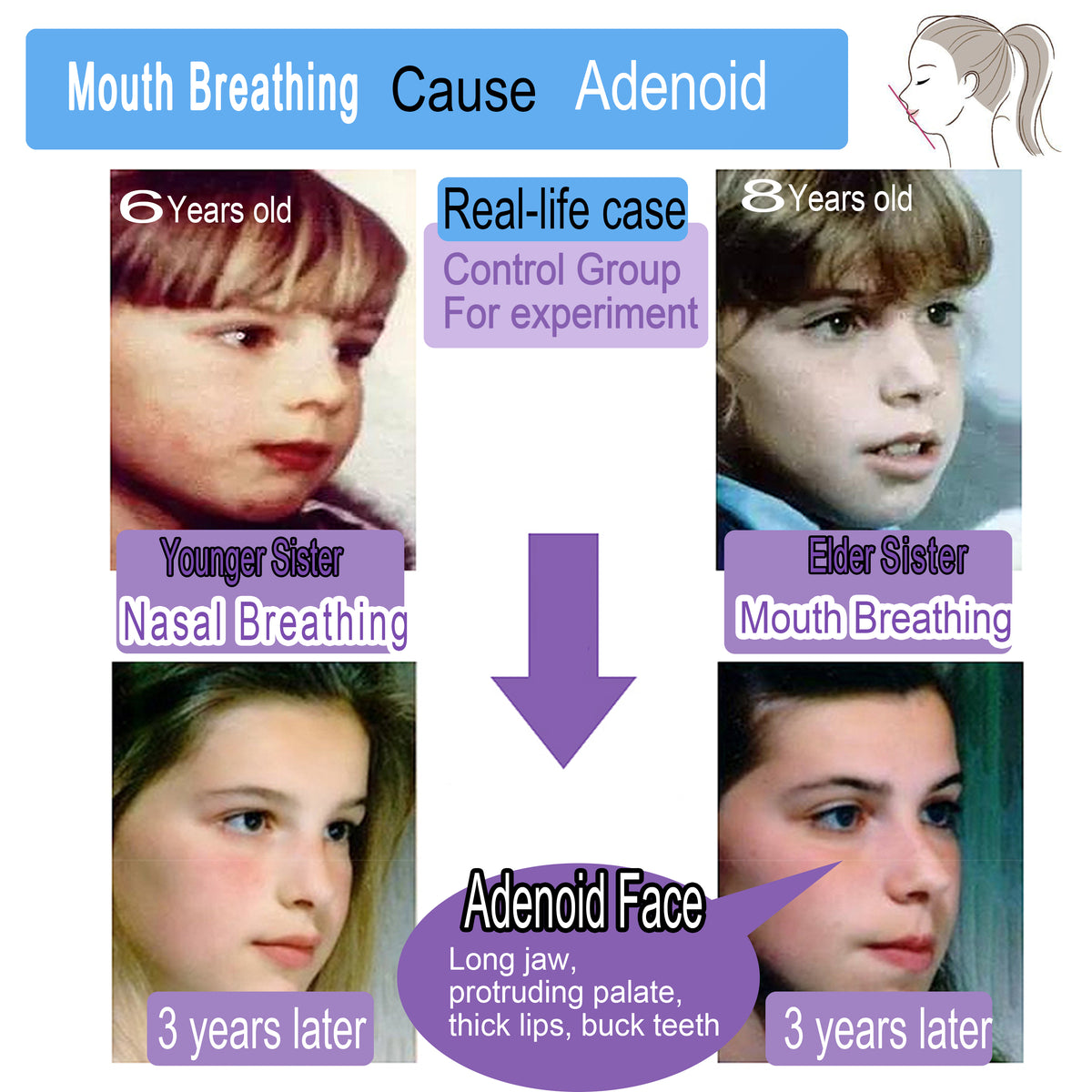 SouZou Mouth Tape For Kids Strong Hold Type