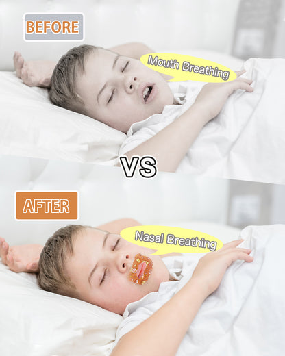 SouZou Mouth Tape For Kids Skin Friendly Type